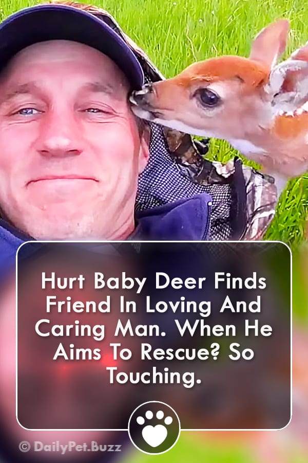 Hurt Baby Deer Finds Friend In Loving And Caring Man. When He Aims To Rescue? So Touching.